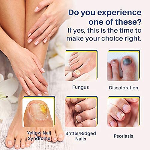 Pulchra Nail Fungus Treatment, Fingernails and Toenails Care Solution with Nail File - Hydrates, Restore and Nourish Discoloration, Brittle, Ridged and Damaged Nails (4 Pcs)