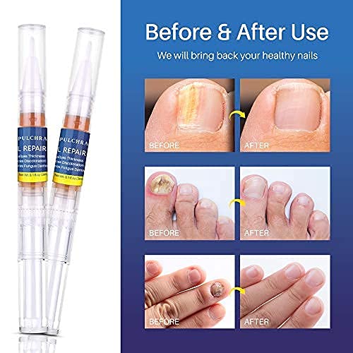 Pulchra Nail Fungus Treatment, Fingernails and Toenails Care Solution with Nail File - Hydrates, Restore and Nourish Discoloration, Brittle, Ridged and Damaged Nails (4 Pcs)