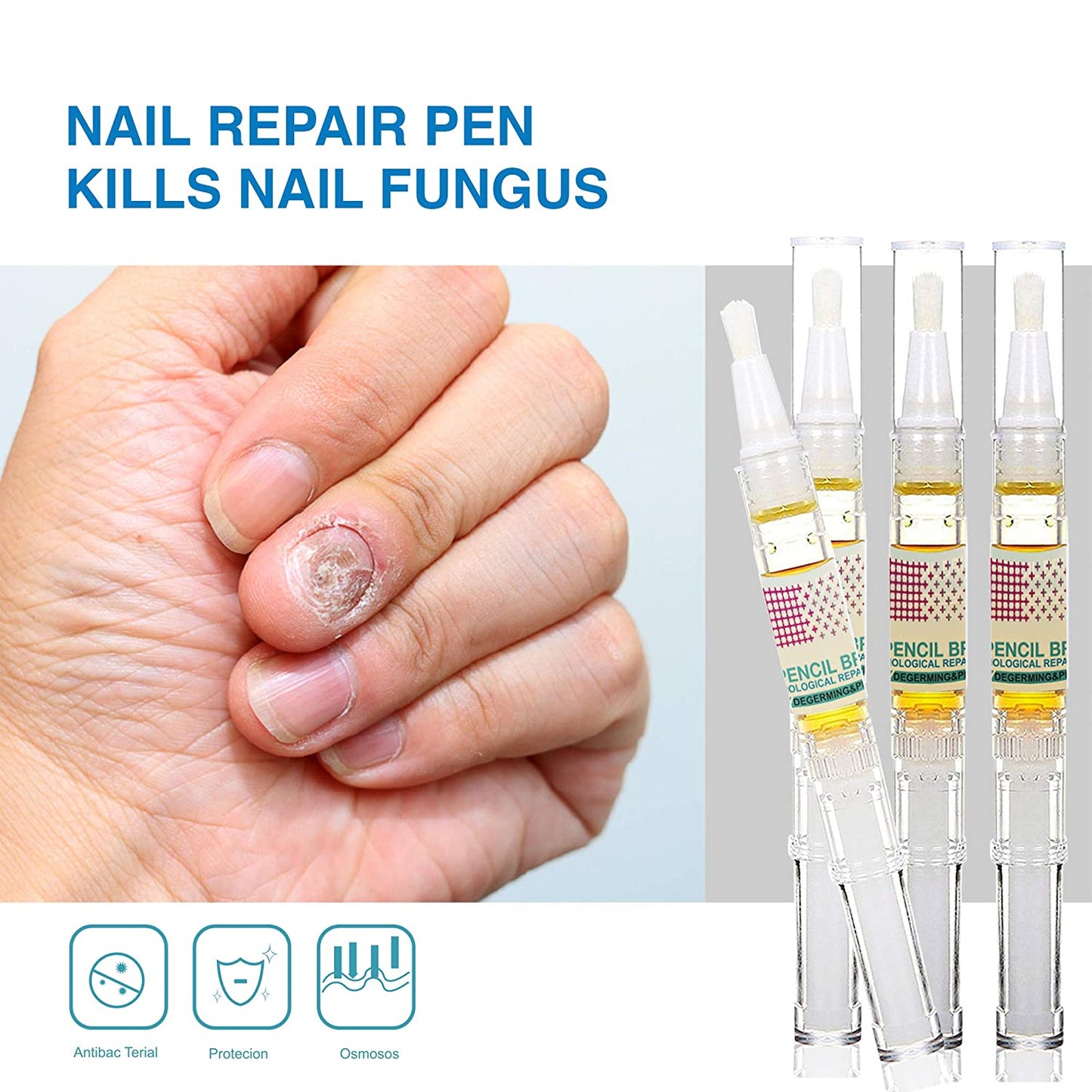 Nail Repair Pen for Toenail and Fingernail, Effective Toe Nail Renewal Solution Extra Strength, Renew Nail Discoloration, Irritations and Ingrown Toenail, Restoring Healthy Nails